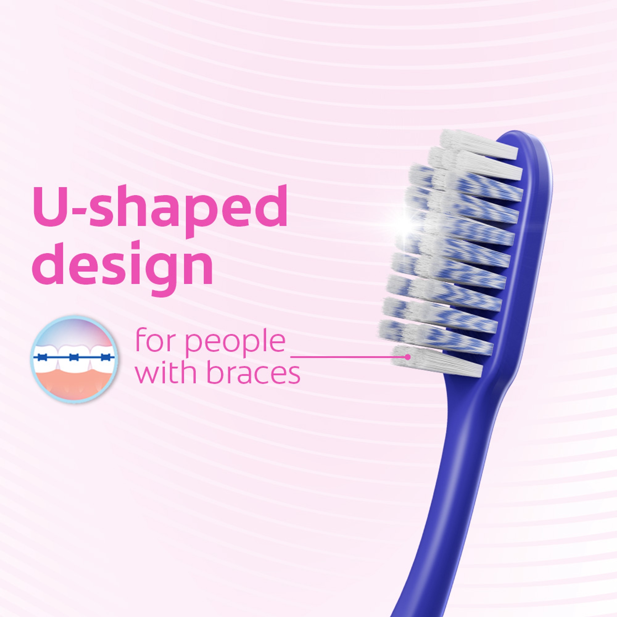 Colgate Ortho Man TB Campaign_Above the Fold